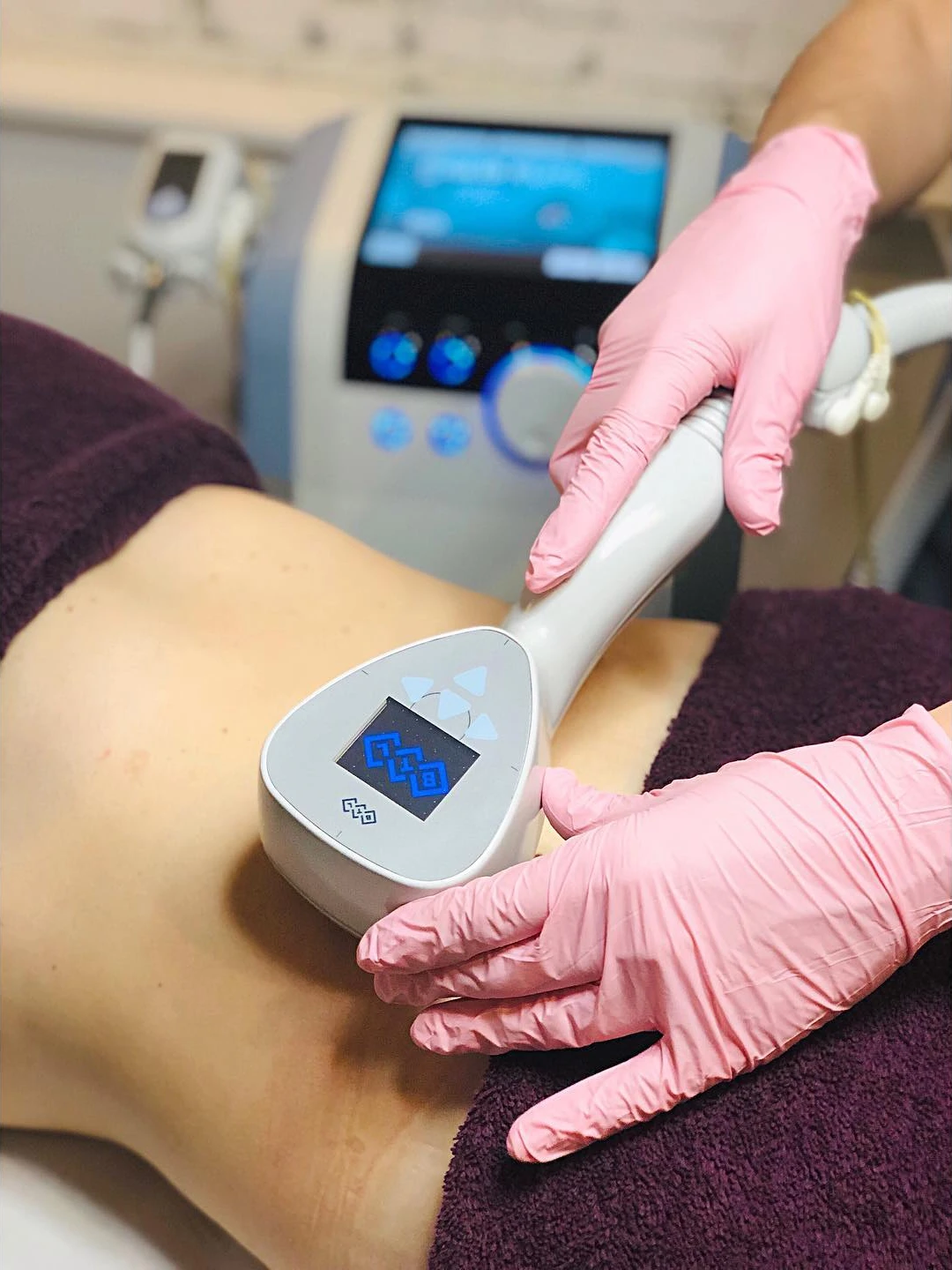 Zabieg Exilis Elite na brzuch w salonie Biały Lotos we Wrocławiu